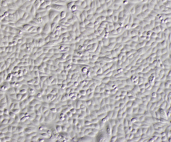 human epidermal keratinocytes activation