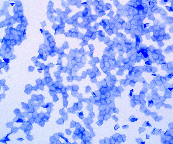 Evaluation of stratum corneum by image analysis